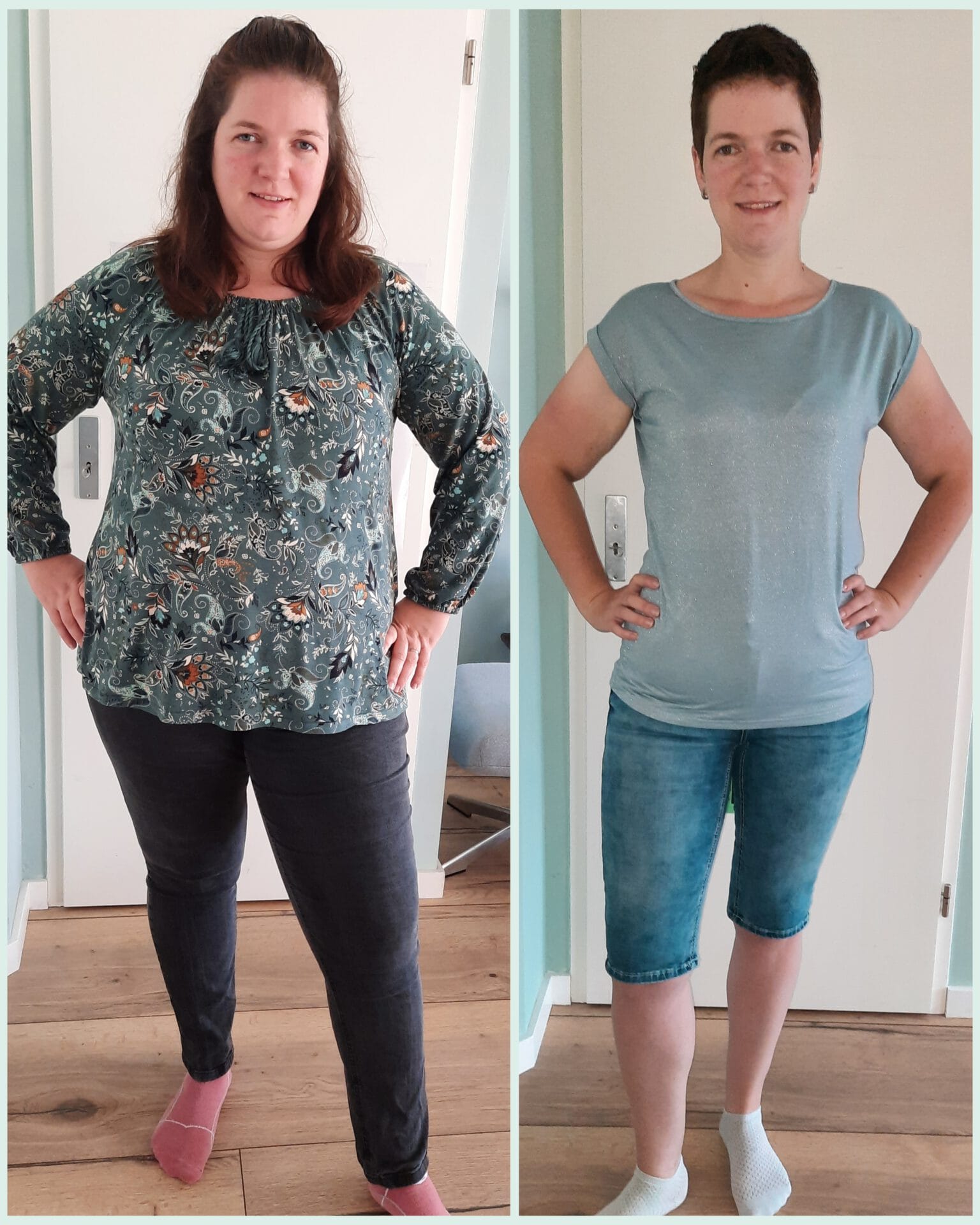 Voor en na foto van Debbie, die aanzienlijk gewicht verloor na een maagverkleining bij WeightWorks.