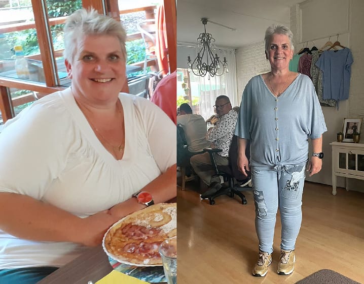 Gastric bypass Voor en na foto van Rita, die aanzienlijk gewicht verloor na een maagverkleining bij WeightWorks